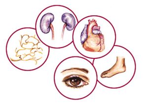 Organs to which complications of diabetes mellitus